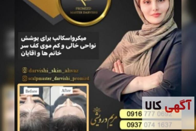 میکرواسکالپ سر