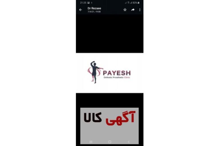 ارتوپدی فنی پایش/اسکن پا/کفی طبی