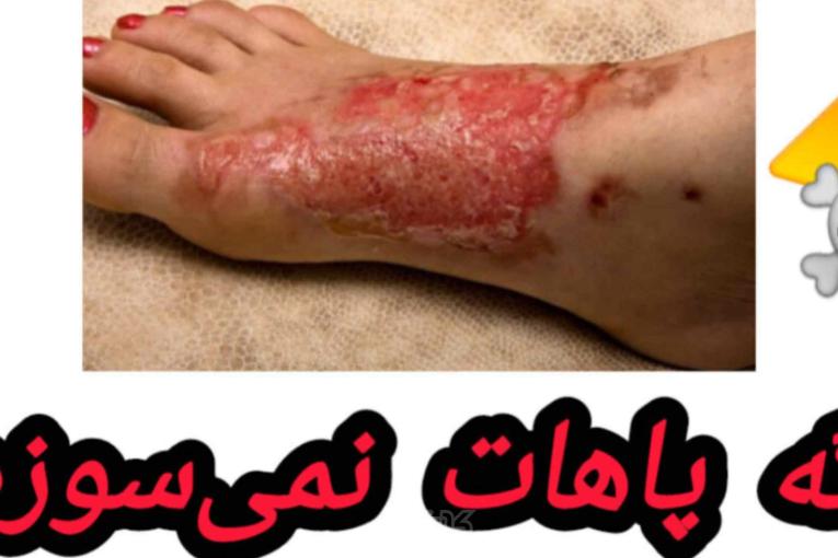 محافظ رادیات بخاری پژو ۲۰۶ و ۲۰۷ و رانا 