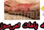 محافظ رادیات بخاری پژو ۲۰۶ و ۲۰۷ و رانا >