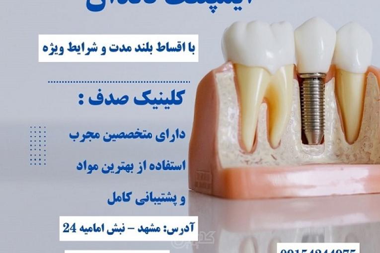 کاشت ایمپلنت بدون فشار مالی با اقساط بلند مدت