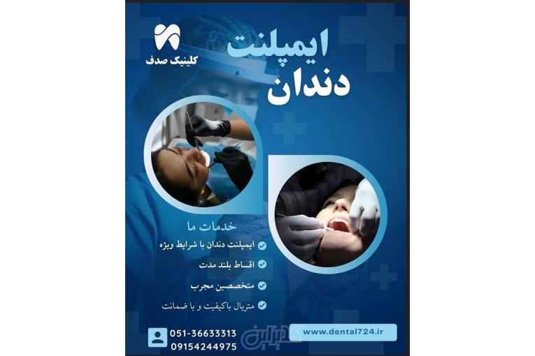 ایمپلنت دندان در مشهد – از دم قسط، بدون سود و بهره!
