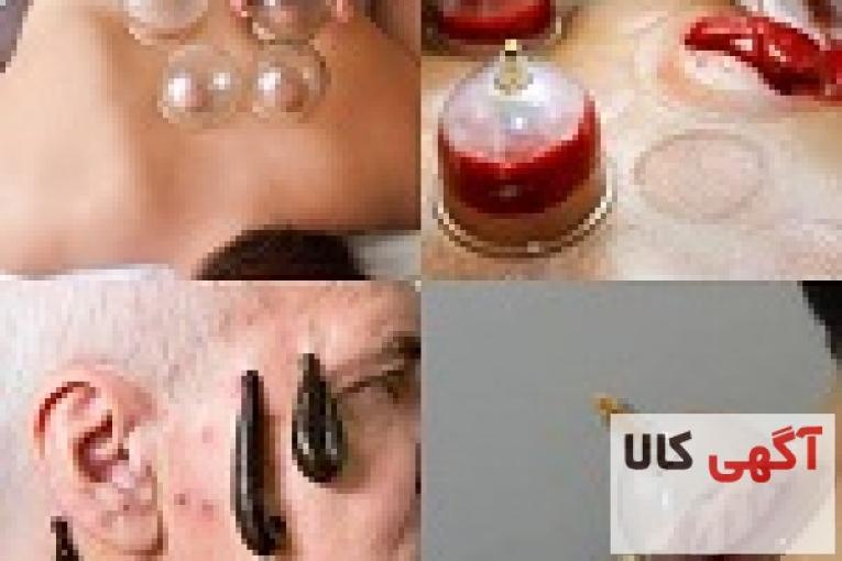 دوره آموزش حجامت زالو درمانی و بادکش
