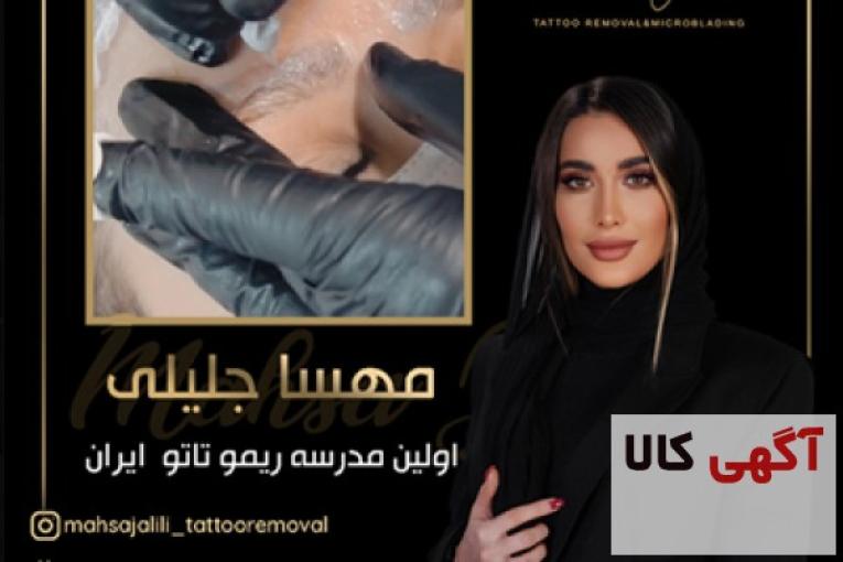 ریموو تاتو ابرو