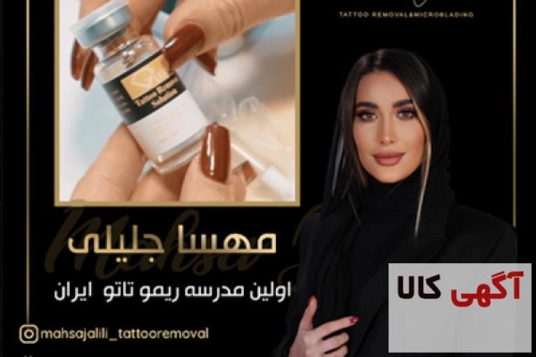 ریموو تاتو خط چشم با کیفیت بسیار عالی در تهران