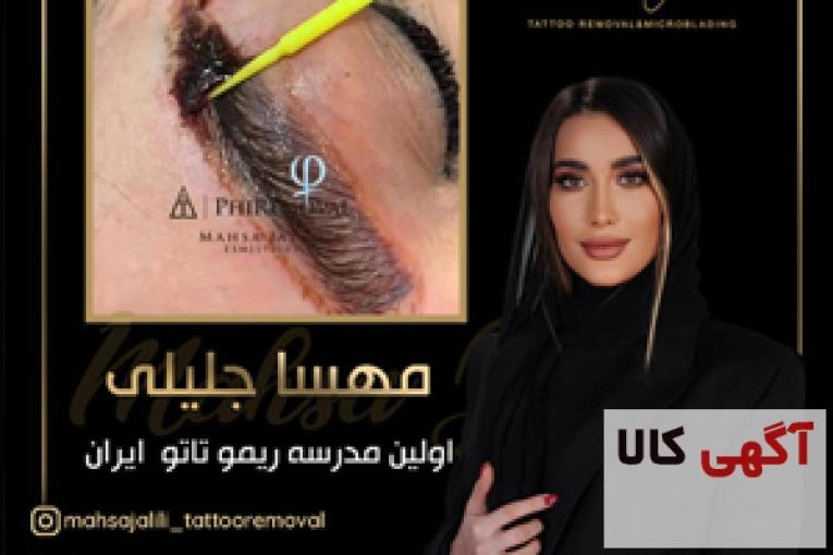  بهترین مرکز ریمو ابرو در تهران 