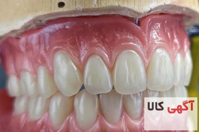 ساخت انواع دندان مصنوعی،ساخت پلاک کروم کبالت براساس فک،ساخت پروتز فلکسی و…