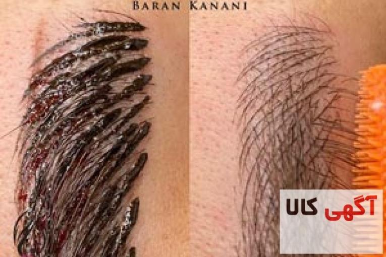 پاک کردن میکروبلیدینگ ابرو در تهران تضمینی