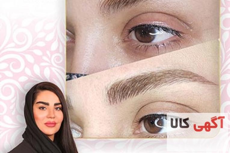 بهترین مرکز میکروبلیدینگ در شرق تهران تضمینی
