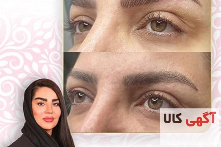 آموزش هاشور فیبروز در شرق تهران با مریم حیدری