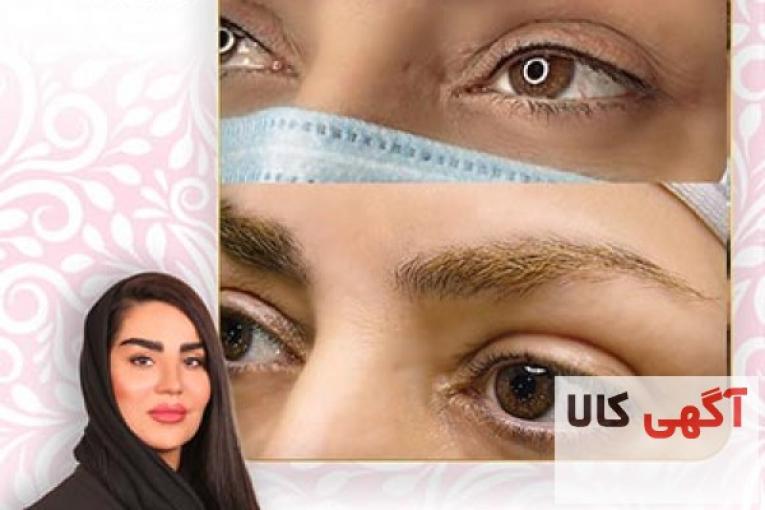 آموزش میکروبلیدینگ در شرق تهران با مریم حیدری