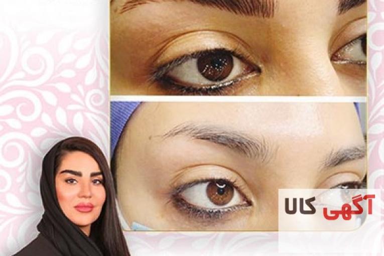 فیبروز ابرو در شرق تهران با مریم حیدری